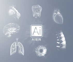 APP开发